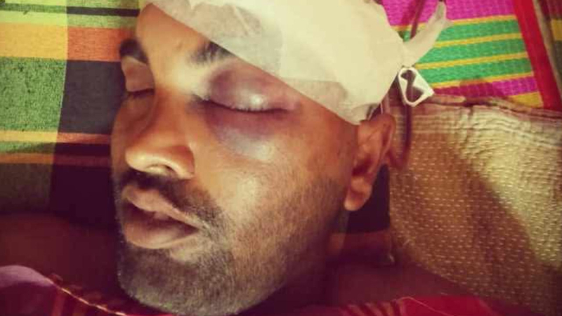মরিচখেতে পানি দেওয়ার  ভিডিও করায় ৭ জনকে পিটিয়ে জখম